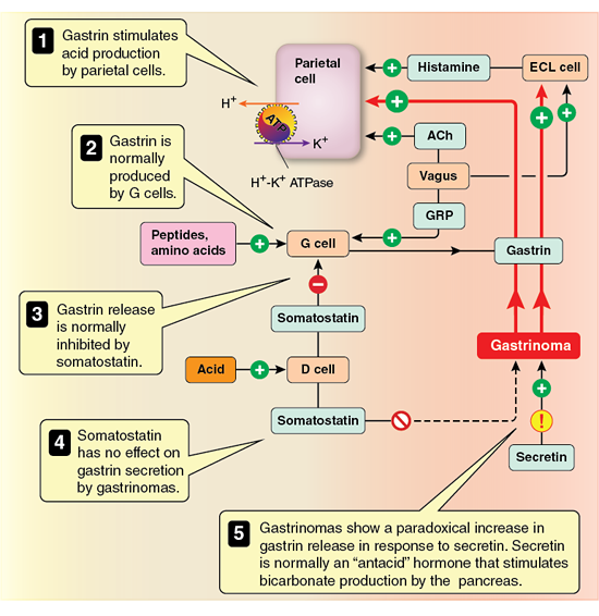Step 1: Hematemesis Flow Chart