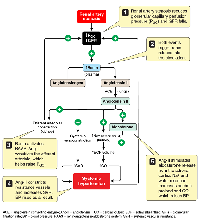 Chest pain flowchart