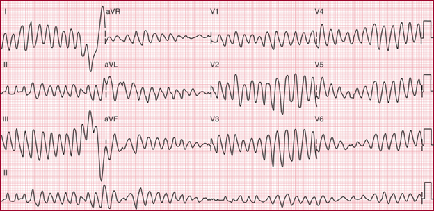 Kaplan Step 2 question - M000693