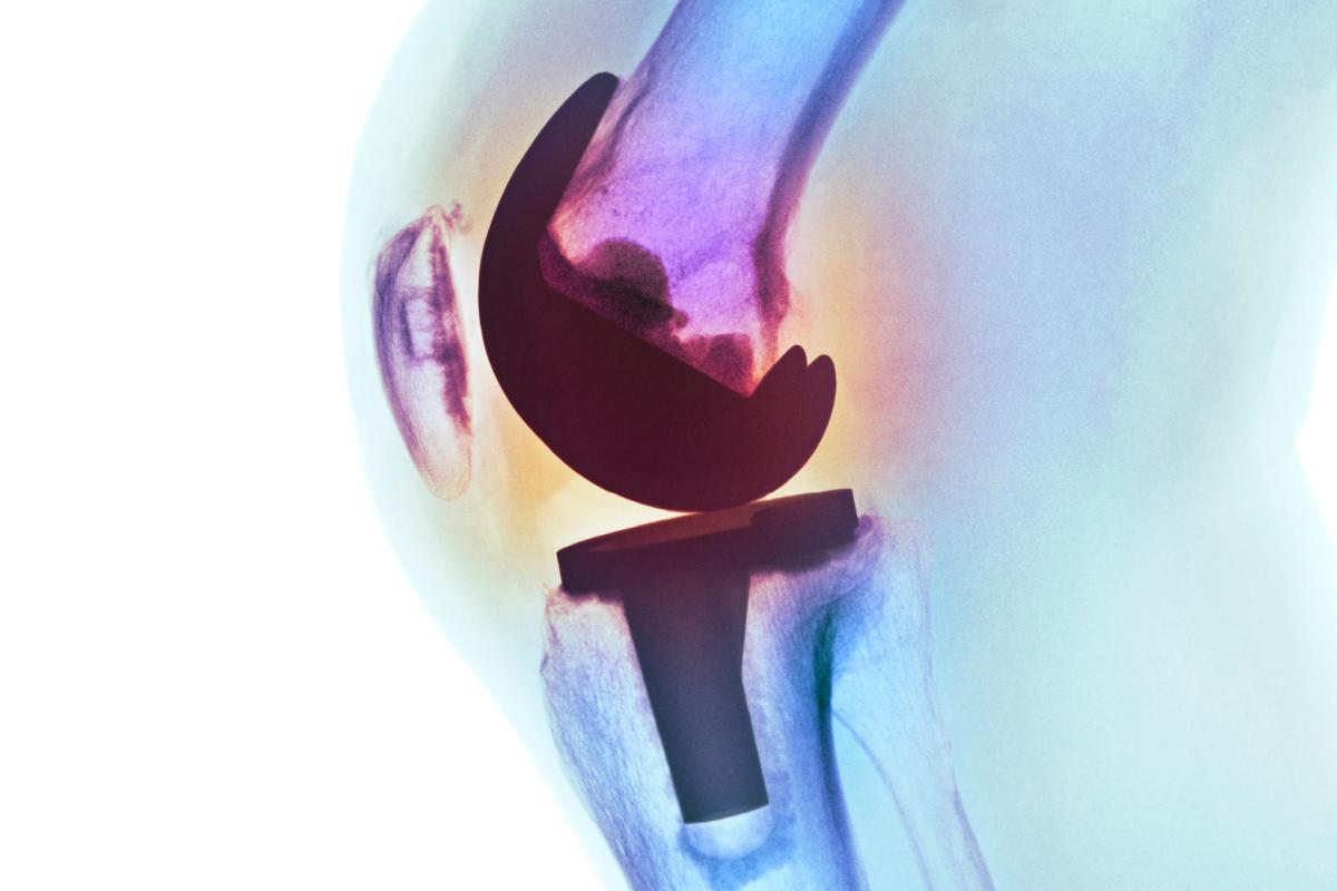 Illustration of knee joint
