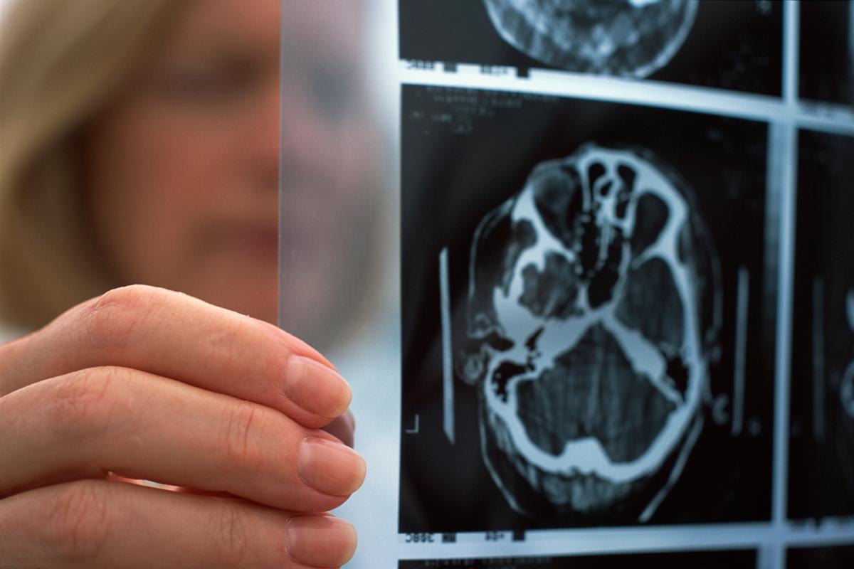 A physician viewing a brain scan
