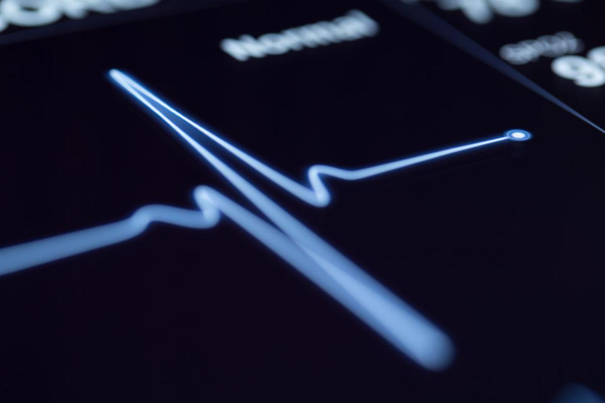 Close up of a heartbeat on a screen