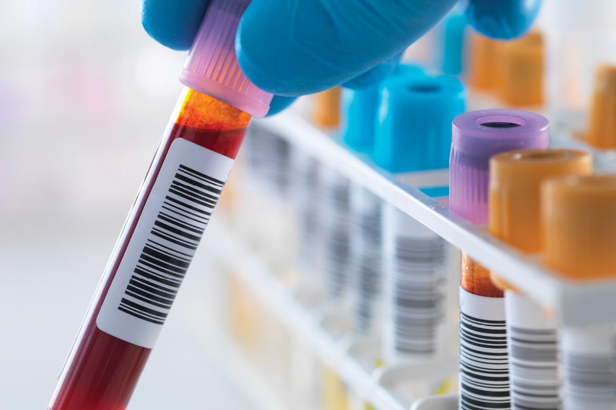 Closeup of phlebotomist holding a vial