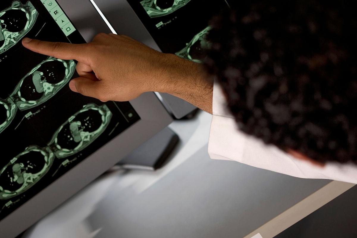 Physician examining a CAT scan monitor