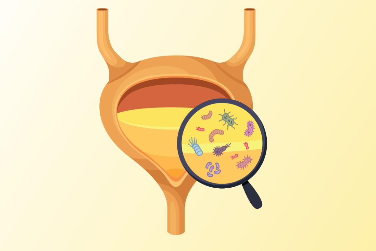 Infection and inflammation of urine and internal organ