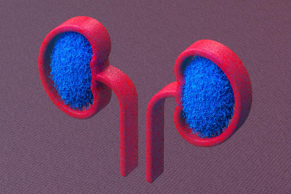 Computer generated kidneys
