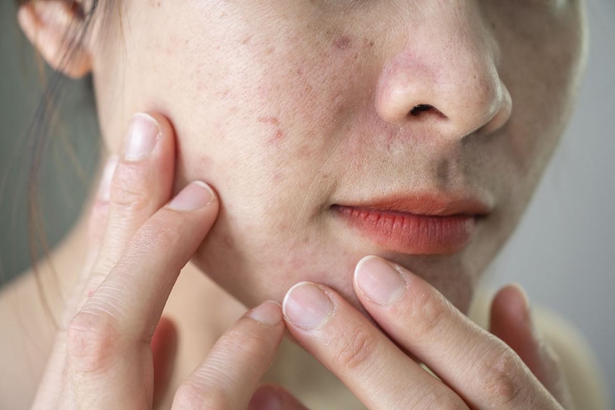 Close up of skin on a person's face