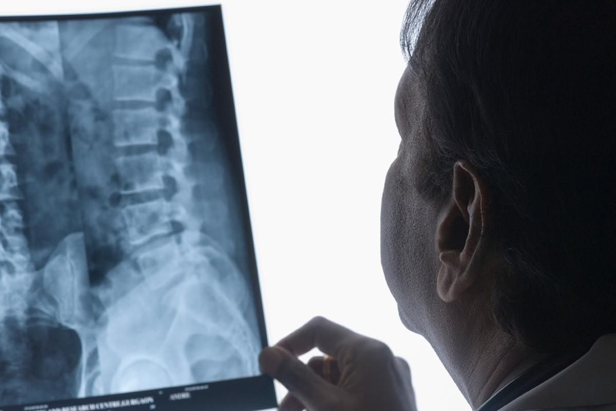 Doctor examining an X-ray image