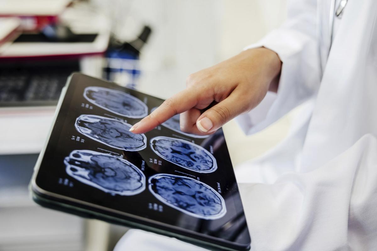  Doctor's hand pointing on brain scan images on digital tablet