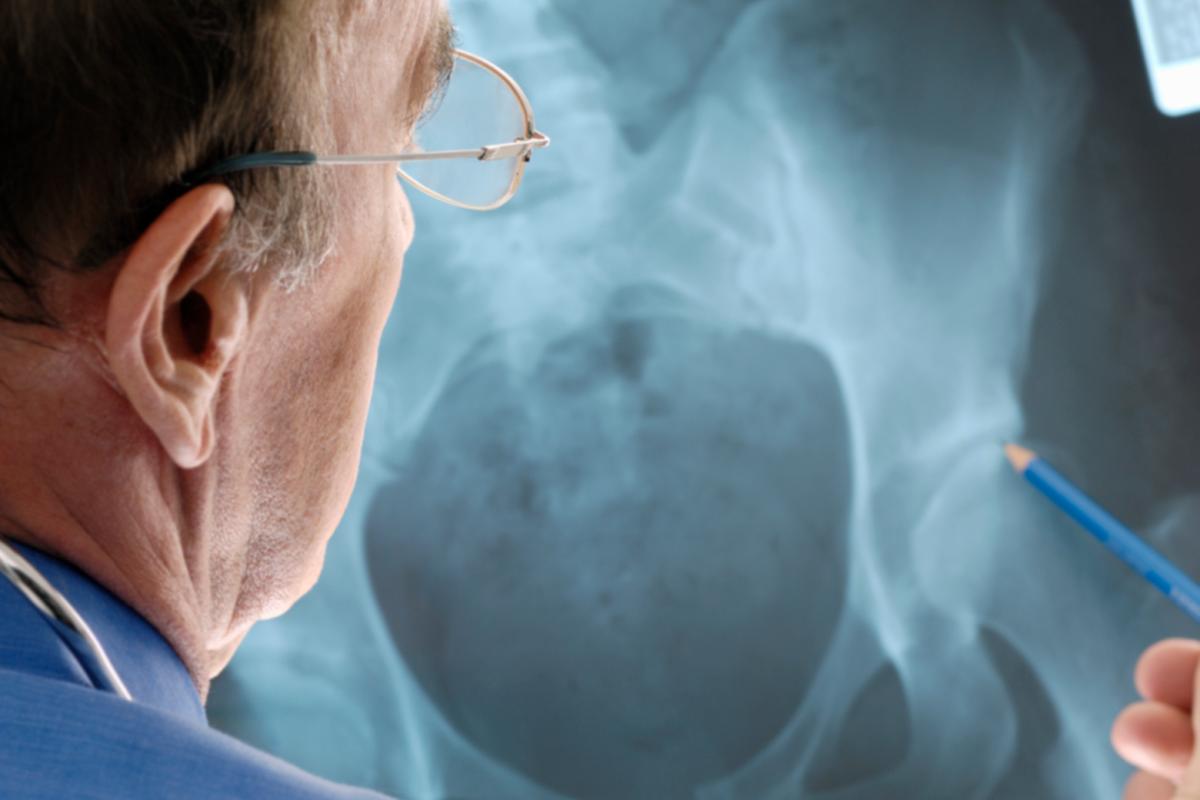 Medical professional reviews x-ray 